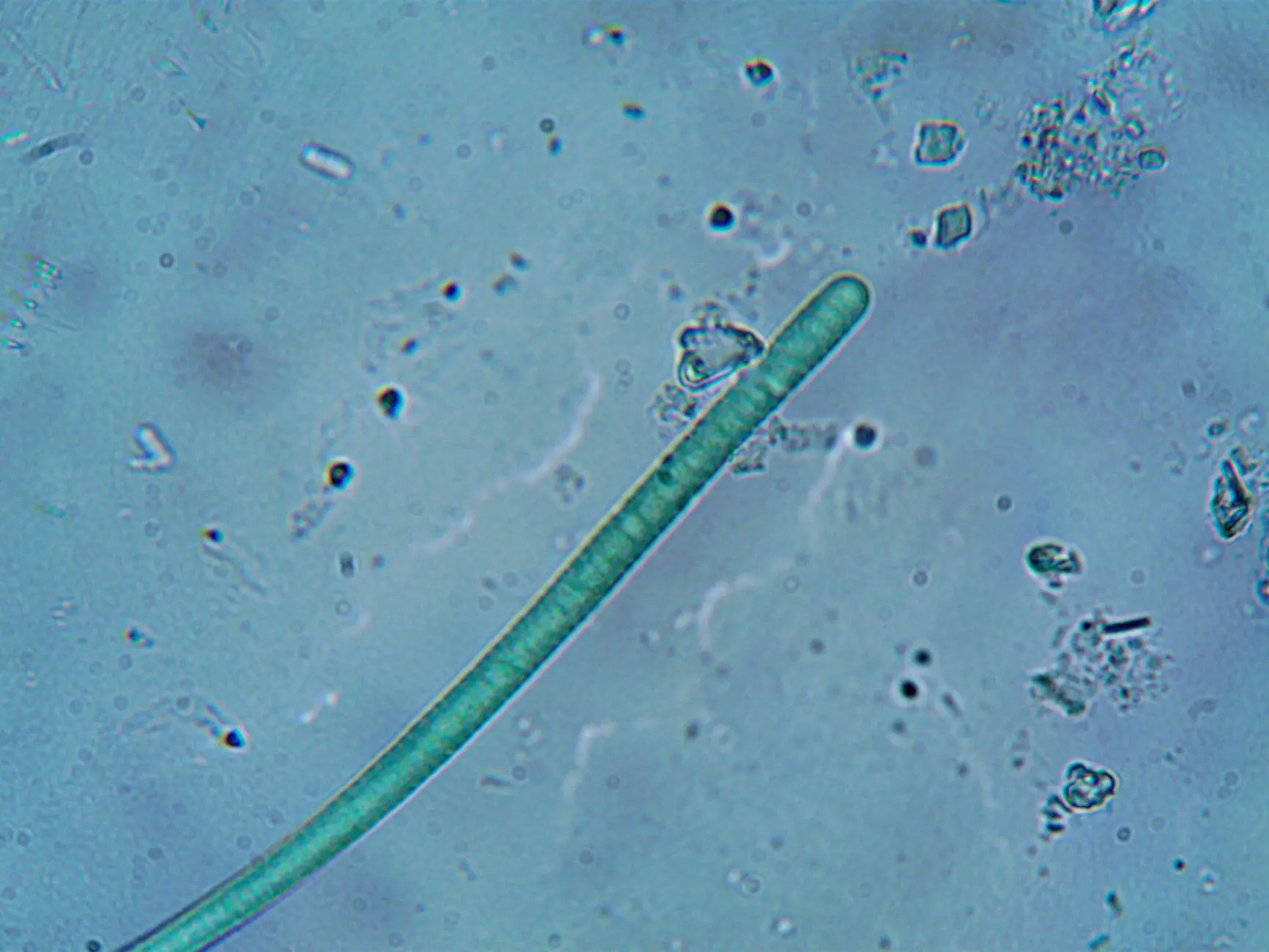 油烟机深度清洗工艺对比：蒸汽高温与生物酶解方案选型指南